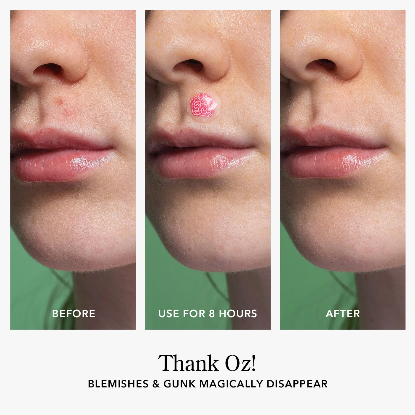 Beekman 1802 x Wicked Thank Oz! Blemish Patches BOGO